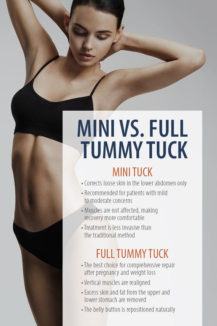 Abdominoplasty Park Cities