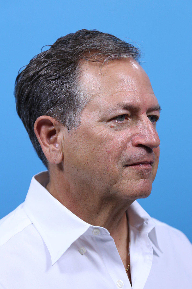 Facelift Before and After | Dr Evan W Beale