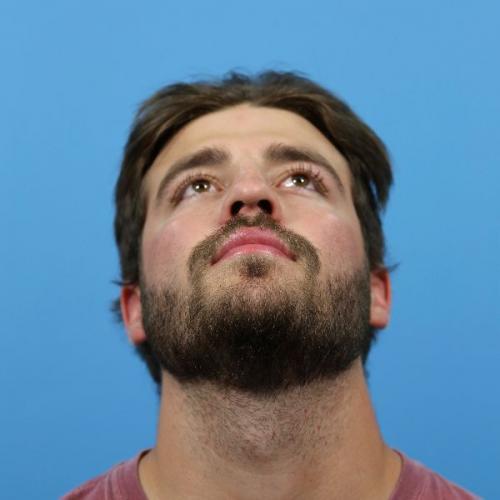 Rhinoplasty Before and After | Dr Evan W Beale