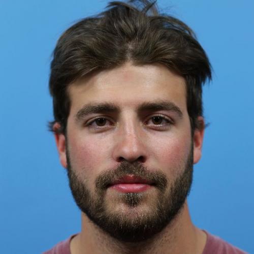 Rhinoplasty Before and After | Dr Evan W Beale