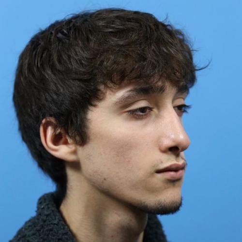 Rhinoplasty Before and After | Dr Evan W Beale