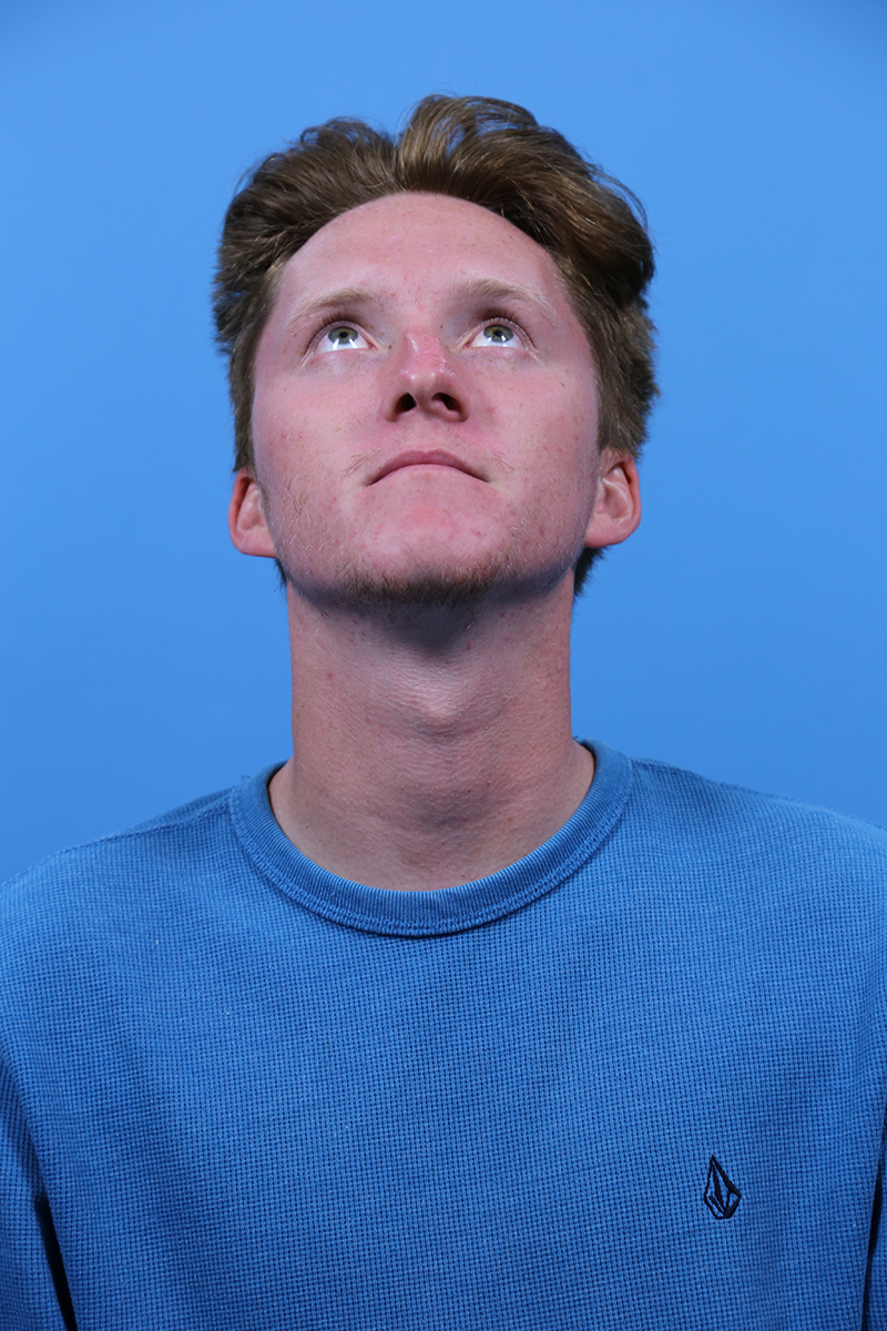 Rhinoplasty Before and After | Dr Evan W Beale